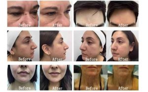 Ha9fc57d368c54223a7ad87023ec00cf15(1)