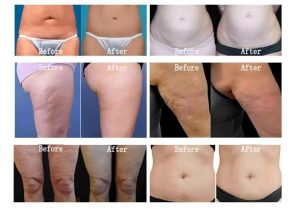 Ha9fc57d368c54223a7ad87023ec00cf15(1)