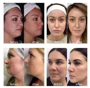 Ha9fc57d368c54223a7ad87023ec00cf15(1)