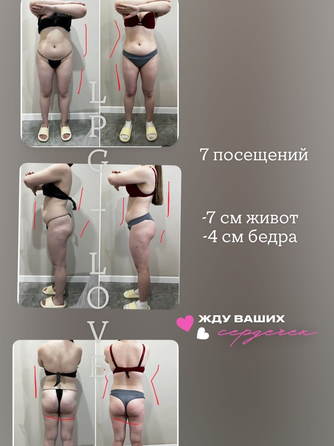 Отзывы покупателей (10)