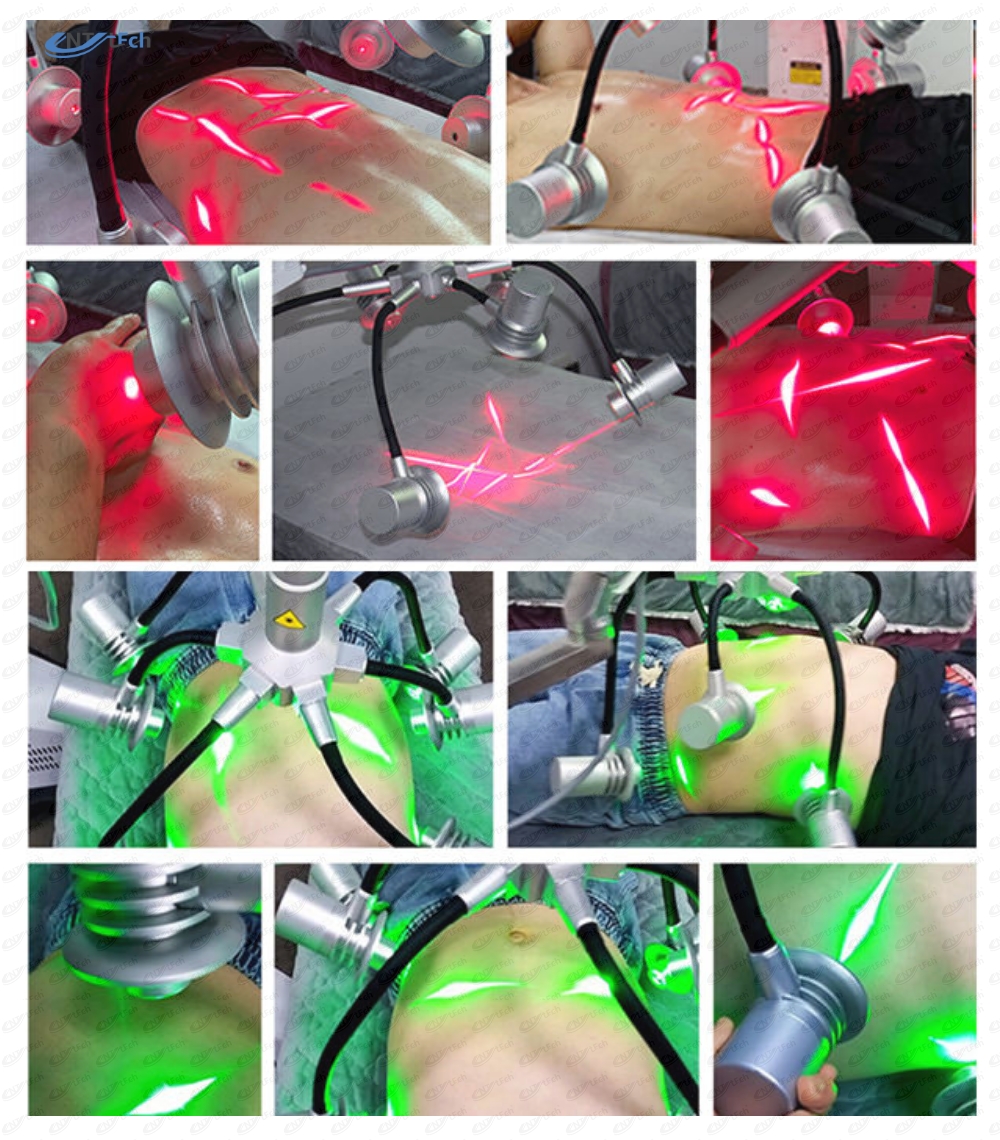 16、6Dlaser – 1