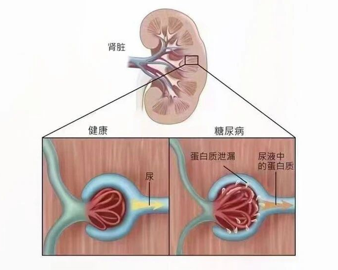 Что именно вы теряете в весе из-за всех этих разговоров о диетах?