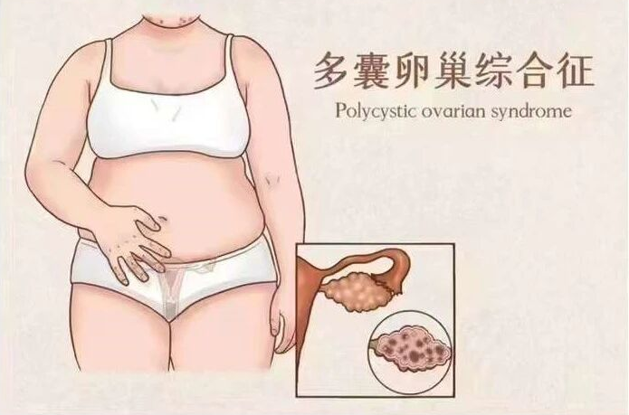 Ожирение — это заболевание номер один, представляющее серьезную угрозу для жизни человека.