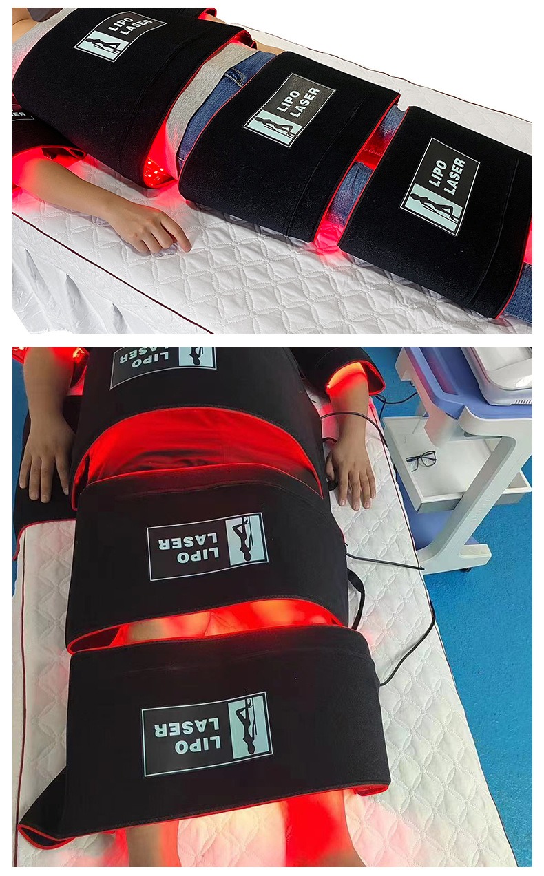 AU-6030B Профессиональная терапия боли Липолазер с длиной волны 650 нм и 940 нм Аппарат Maxlipo 5D для похудения