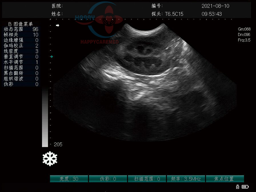 HC-A003A VET Черно-белая полностью цифровая портативная диагностическая ультразвуковая система для животных, сканер для беременности, ультразвуковой аппарат
