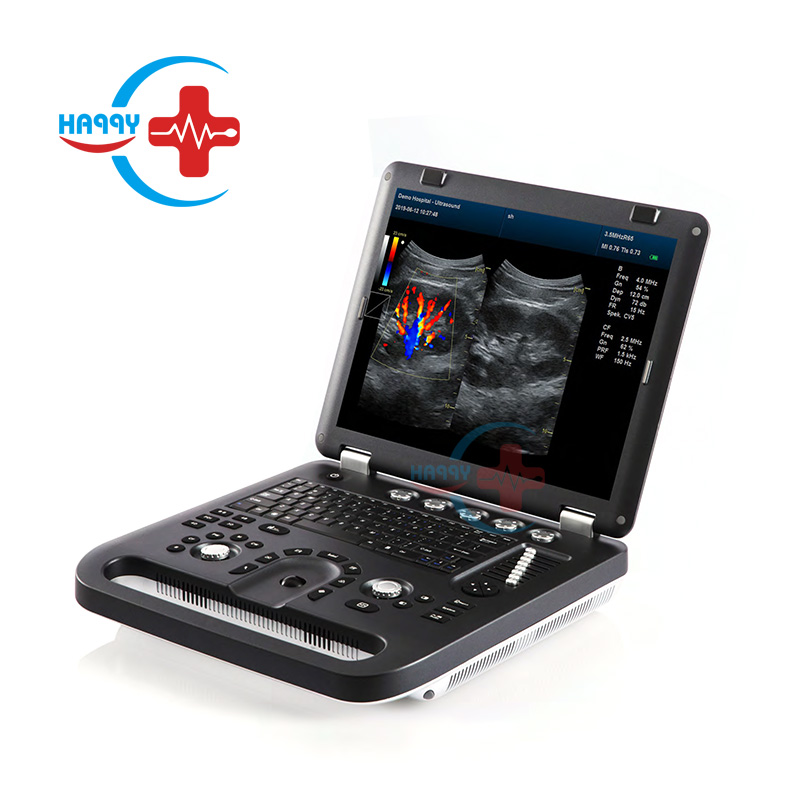 HC-A013A Медицинский УЗИ-ноутбук Цветная допплеровская ультразвуковая диагностическая система Портативный ультразвуковой аппарат