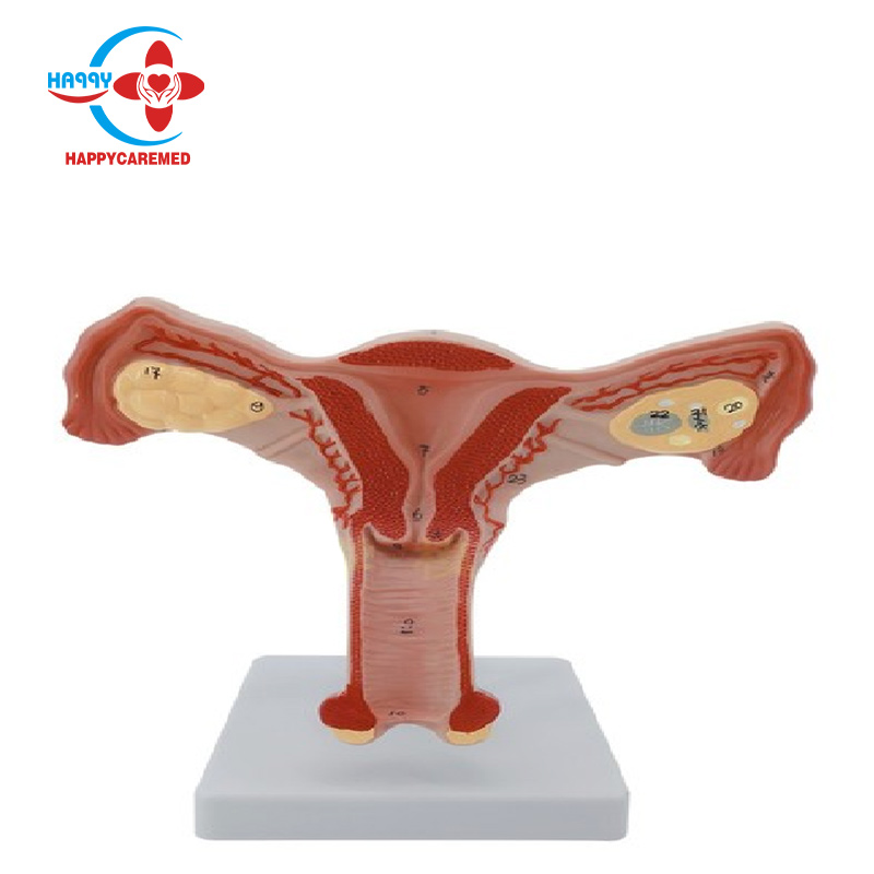 HC-S350 гинекологическая учебная модель, анатомическая модель матки, двусторонняя модель матки, яичников