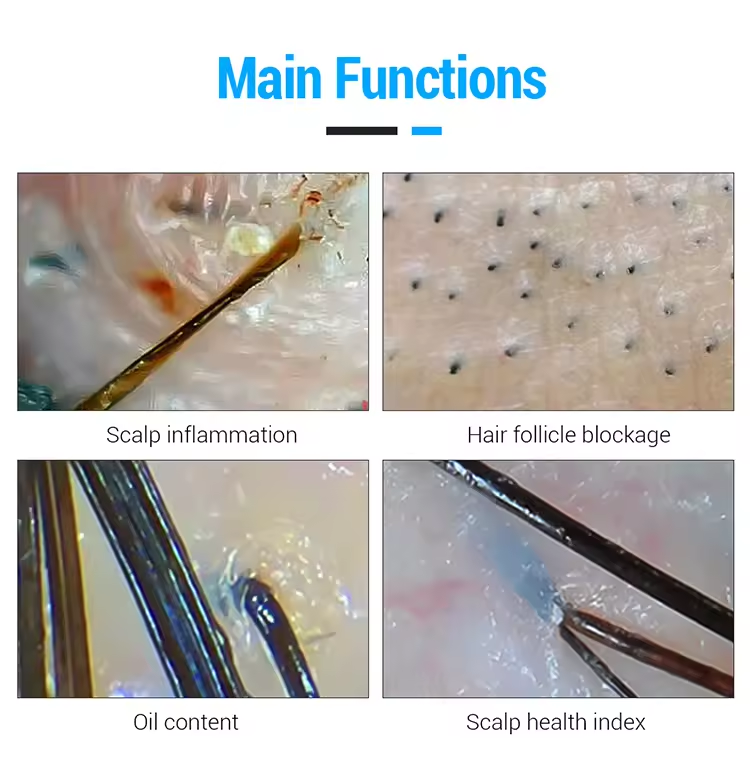Портативный анализатор волос с большим экраном, машина для лечения кожи головы, спа-оборудование