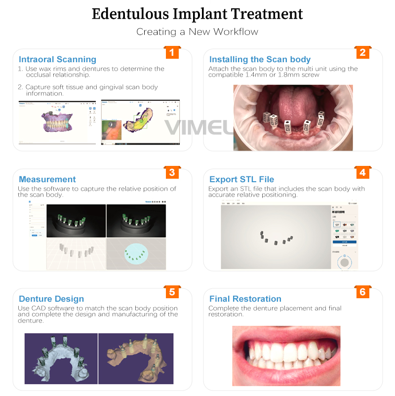 WM-iMapper-口腔数字化种植定位仪_06